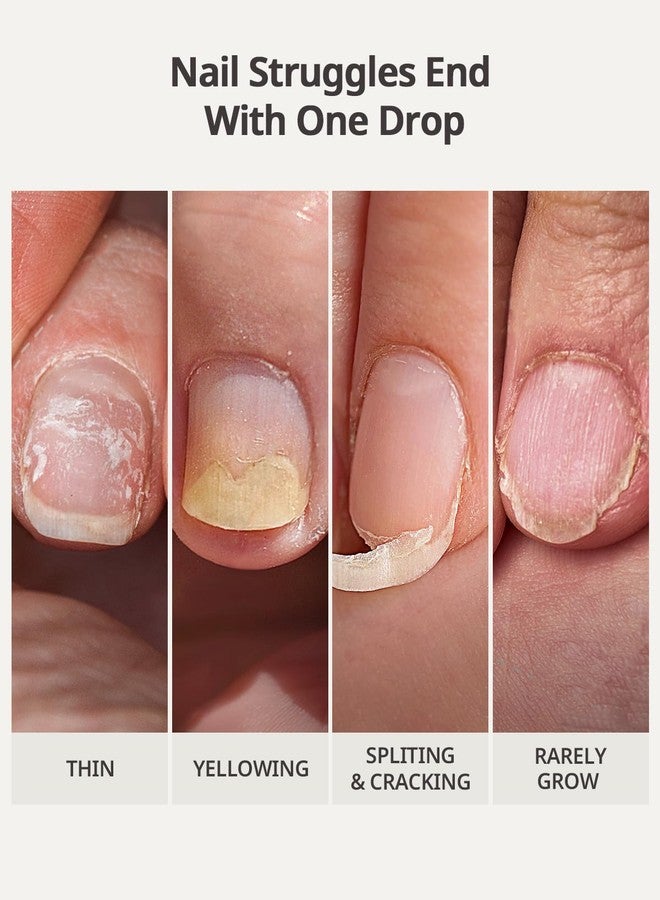 btartboxnails مقوي أظافر BTARTBOXNAILS Nailush ومُحفز نمو الأظافر - يُصلح الأظافر التالفة، ويُقوي الأظافر الضعيفة والرقيقة، ويُعزز نمو الأظافر بشكل فائق، ويُقوي الأظافر لفترة طويلة، 15 مل - Image 4